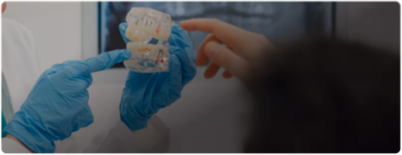 A dentist wearing blue gloves holds a dental mold while another person points at it, suggesting a discussion about dental care or treatment options.