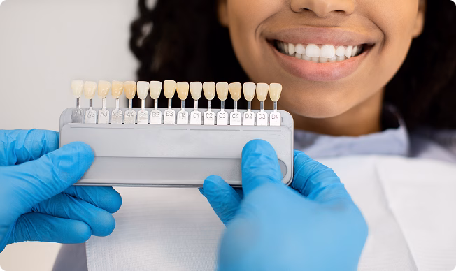 A dentist in blue gloves holds a shade guide next to a smiling person's teeth, showing various tooth colors to match for dental treatment.