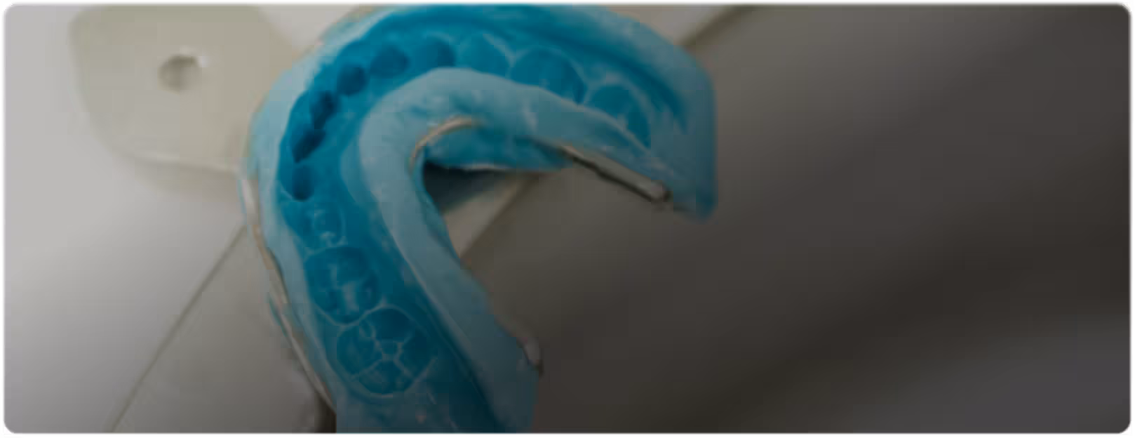 Close-up of a blue dental impression tray on a white surface, capturing detailed tooth imprints. The scene conveys a clinical, precise tone.