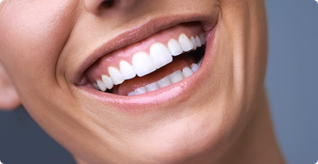 A close-up image of a person’s mouth smiling, showing bright white teeth. The skin tone is warm, conveying happiness and confidence against a gray background.